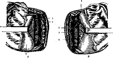 Bronchi: figure 10 from the 1928–1936 encyclopedia article