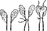 Bronchi: figure 12 from the 1928–1936 encyclopedia article