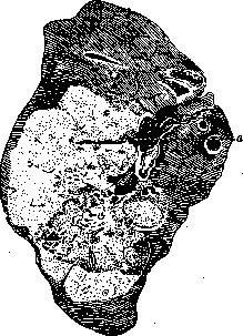 Bronchi: figure 18 from the 1928–1936 encyclopedia article