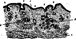 Anemia: figure 1 from the 1928–1936 encyclopedia article