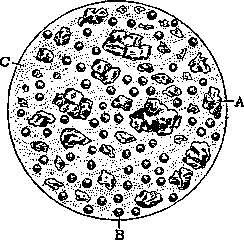 Duodenal Tube (duodenal sounding, and duodenal): figure 1 from the 1928–1936 encyclopedia article