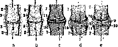 Articular Menisci: figure 1 from the 1928–1936 encyclopedia article