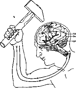 Will and Its Disorders: figure 1 from the 1928–1936 encyclopedia article