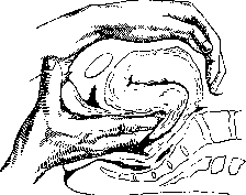 Postpartum Period: figure 17 from the 1928–1936 encyclopedia article