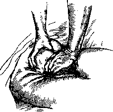 Postpartum Period: figure 6 from the 1928–1936 encyclopedia article