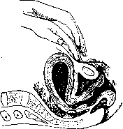 Postpartum Period: figure 23 from the 1928–1936 encyclopedia article