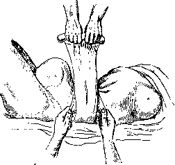 Postpartum Period: figure 14 from the 1928–1936 encyclopedia article