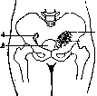 Postpartum Period: figure 25 from the 1928–1936 encyclopedia article