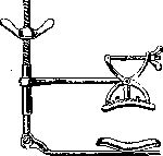 Postpartum Period: figure 11 from the 1928–1936 encyclopedia article