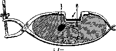 Postpartum Period: figure 10 from the 1928–1936 encyclopedia article