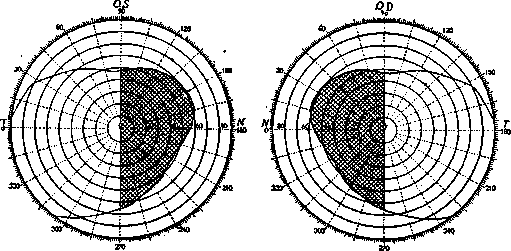 Hemianopsia: figure 3 from the 1928–1936 encyclopedia article