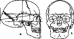 Facial Nerve (FACIAL NERVE, see Facialis): figure 12 from the 1928–1936 encyclopedia article