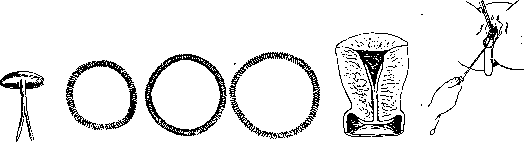 Contraceptives: figure 31 from the 1928–1936 encyclopedia article