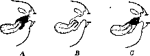 Contraceptives: figure 4 from the 1928–1936 encyclopedia article