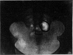 Contraceptives: figure 23 from the 1928–1936 encyclopedia article