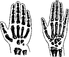 Hand: figure 1 from the 1928–1936 encyclopedia article