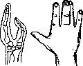 Hand: figure 11 from the 1928–1936 encyclopedia article