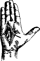 Hand: figure 13 from the 1928–1936 encyclopedia article