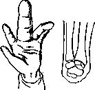 Hand: figure 10 from the 1928–1936 encyclopedia article