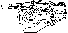 Prostheses: figure 8 from the 1928–1936 encyclopedia article