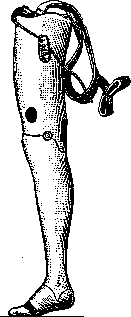 Prostheses: figure 1 from the 1928–1936 encyclopedia article