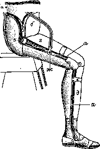 Prostheses: figure 2 from the 1928–1936 encyclopedia article