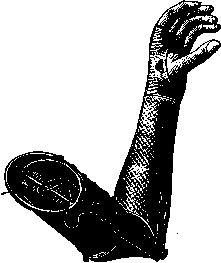 Prostheses: figure 5 from the 1928–1936 encyclopedia article