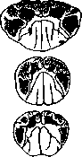 Amyotrophic Lateral Sclerosis: figure 1 from the 1928–1936 encyclopedia article