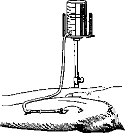 Infusion: figure 3 from the 1928–1936 encyclopedia article