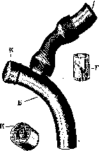 Larynx: figure 11 from the 1928–1936 encyclopedia article