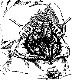 Larynx: figure 10 from the 1928–1936 encyclopedia article
