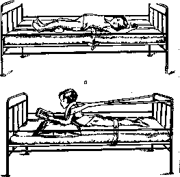 Spondylitis: figure 21 from the 1928–1936 encyclopedia article