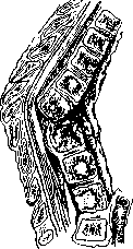 Spondylitis: figure 14 from the 1928–1936 encyclopedia article
