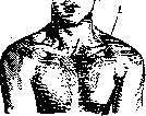 Mohrenheim's Fossa: figure 1 from the 1928–1936 encyclopedia article
